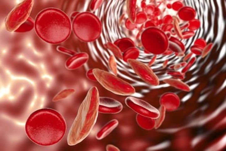 Durante la anemia la concentración de hemoglobina en los glóbulos rojos es inferior a lo normal.